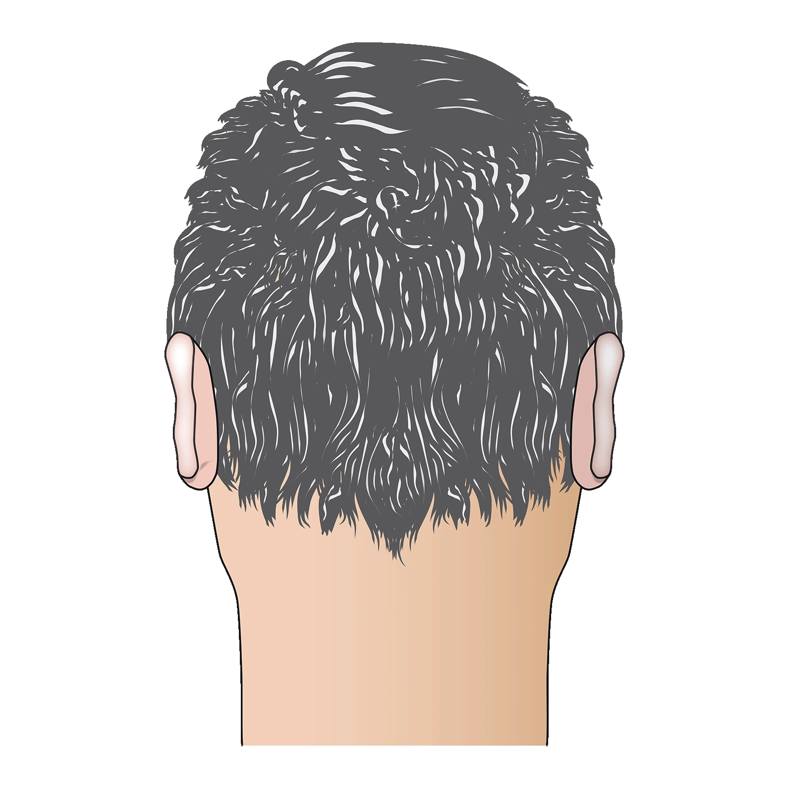 Bild 8: Endergebnis der FUE-Trannsplantation - Grafik eines männlichen Hinterkopfes mit vollem Haarwuchs